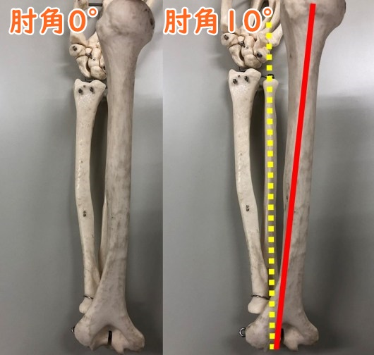 上肢の骨模型。肘を曲げる角度の比較で0°と10°の２パターンあり。