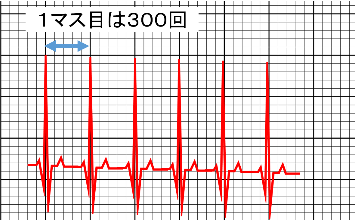 危険な心拍数とは何ですか?