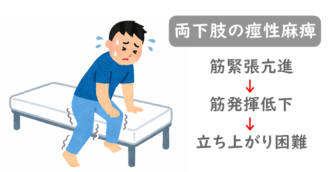 ベッドで立ち上がろうとする男性のイラスト。下肢がつっぱってしまい立ち上がれない様子。