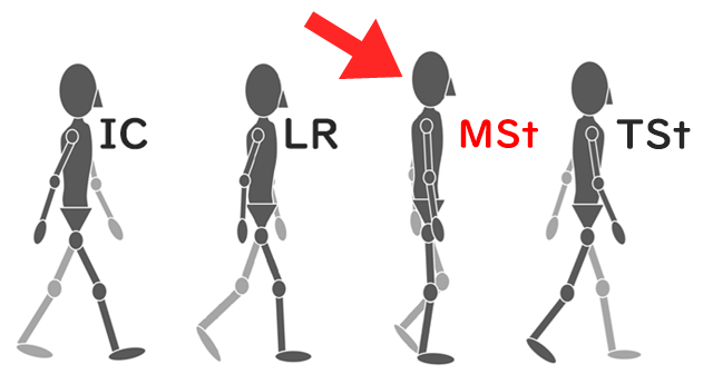 スティックピクチャーで立脚期の歩行周期を表現。どこが立脚中期なのかを解説。