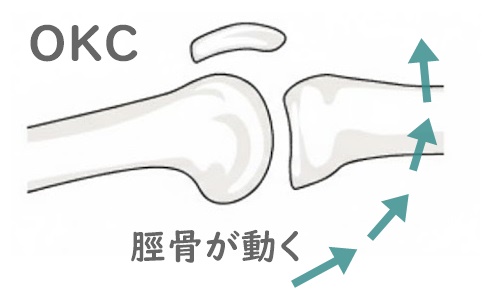 大腿骨に対して脛骨が動いているイラスト。