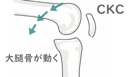 脛骨に対して大腿骨が動いているイラスト。