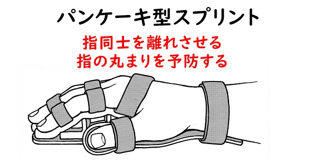 パンケーキ型スプリントのイラスト。指同士のスペース確保や手指の丸まりを予防する効果を解説。