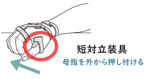 短対立装具のイラスト。母指を外側から押し付ける機能を解説。