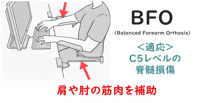 Balanced Forearm Orthosisのイラスト。C5レベルの脊損患者が適応となることを解説。