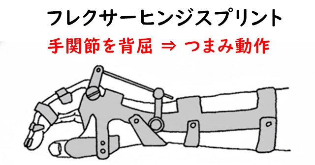 フレクサーヒンジスプリントのイラスト。