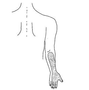 第45回 午後17で使用されている画像。右前腕後面と手背面がグレーに塗られているイラスト。