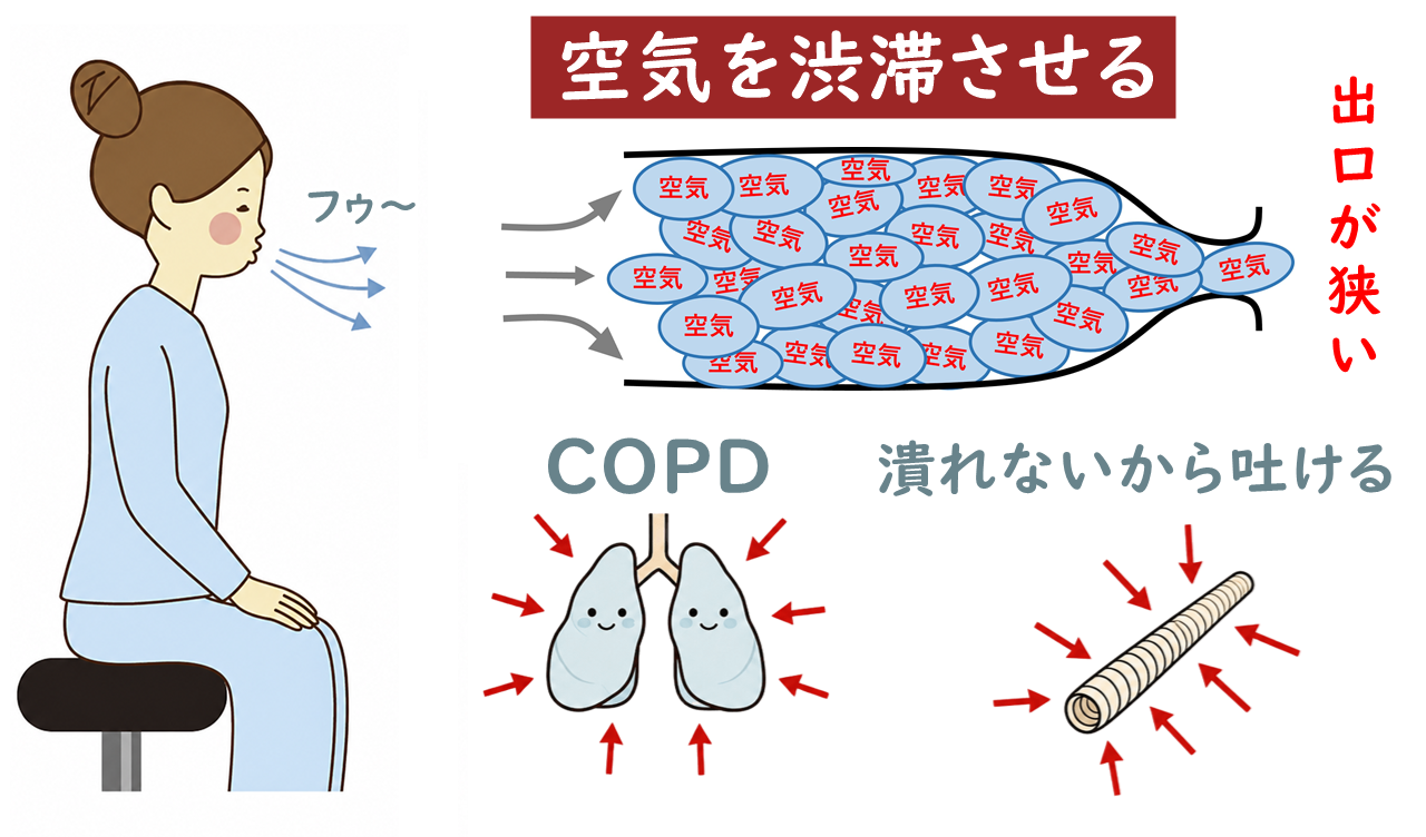 口すぼめ呼吸をする女性のイラスト。空気の渋滞が気管支がつぶれるのを防いでいることを伝えている。