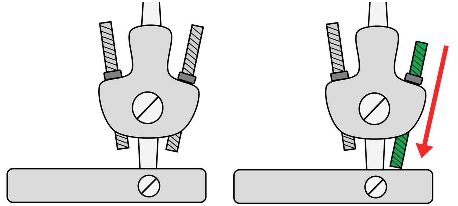2つのダブルクレンザック継手のイラスト。一方は後ろのロッドが下がっている。