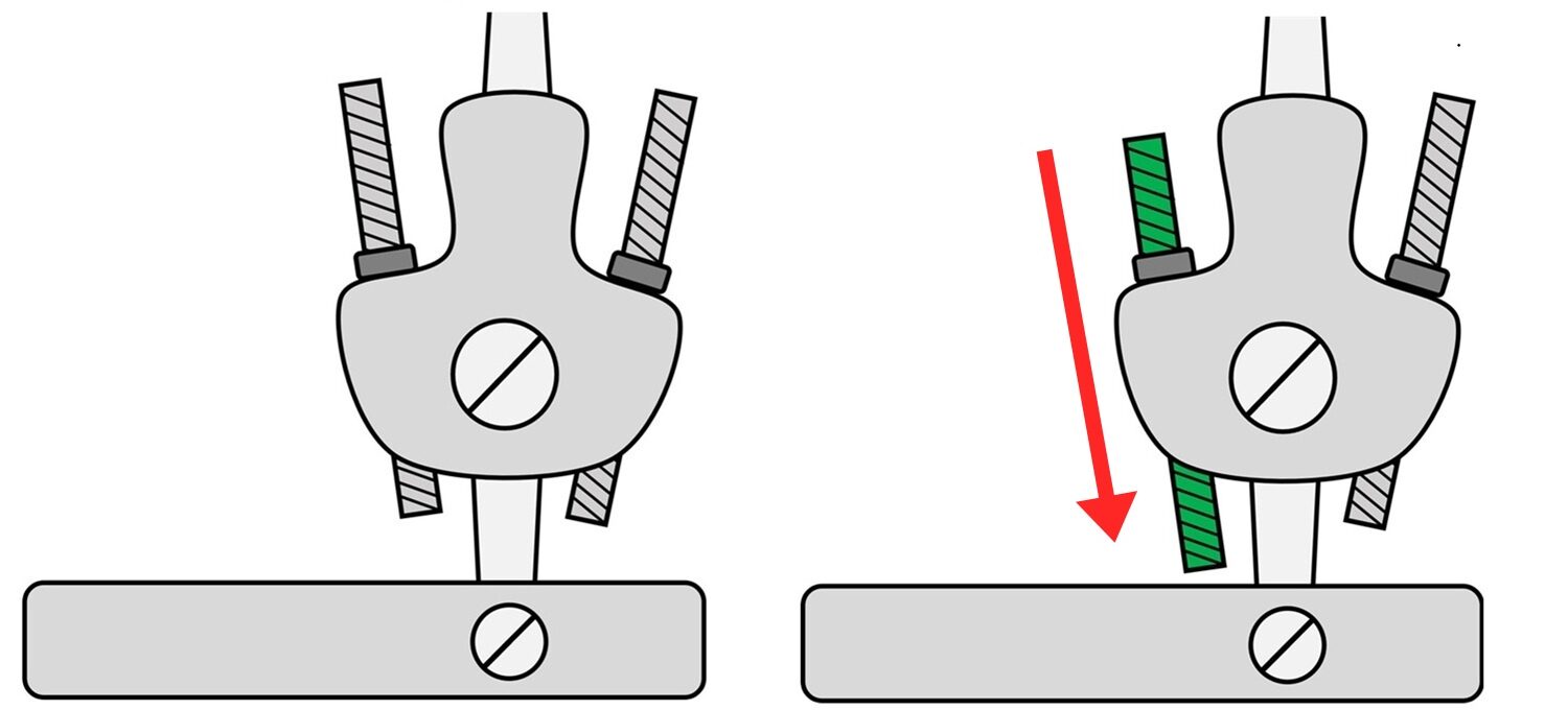 2つのダブルクレンザック継手のイラスト。一方は前のロッドが下がっている。