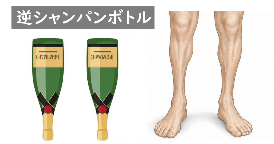 逆さまにしたシャンパンボトルと萎縮した下腿のイラスト